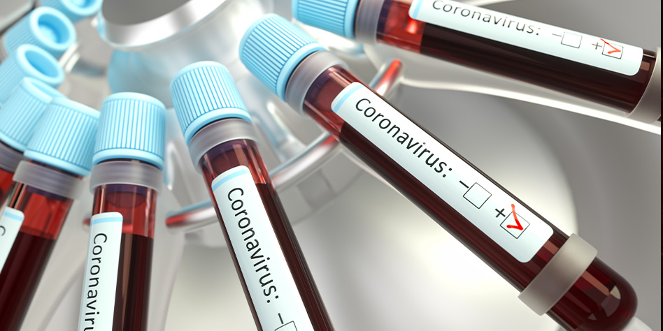 IL Virus (che non c’è) e le Cure – FABIO FRANCHI – Infettivologo