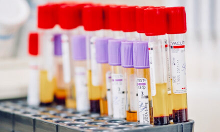 Test PCR Totalmente Inaffidabili. Ecco perché